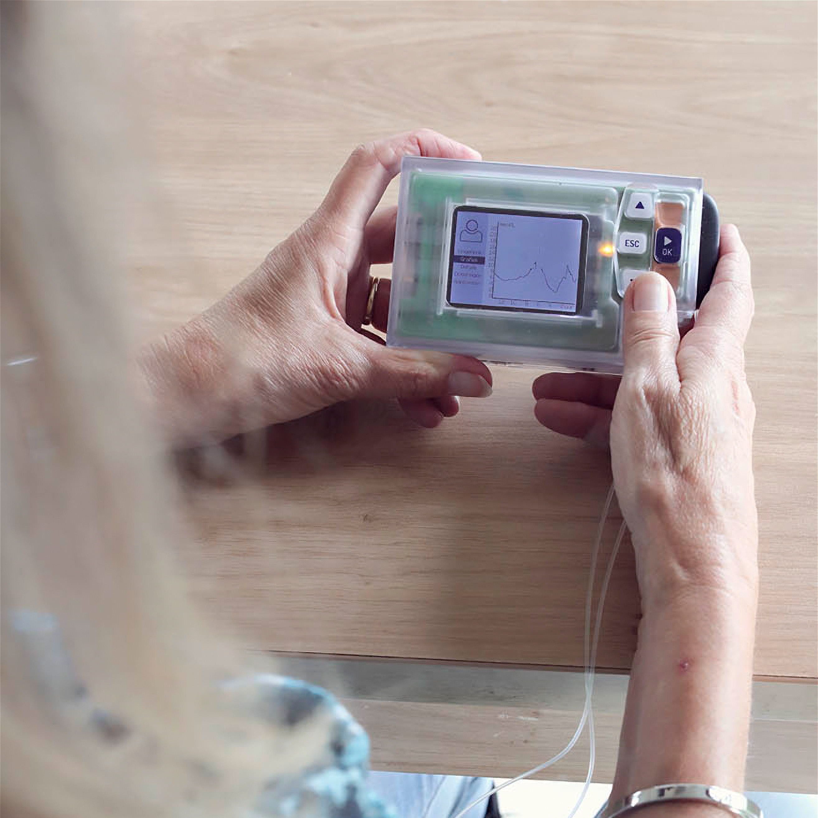 Interne Geneeskunde Kunstmatige Alvleesklier 01